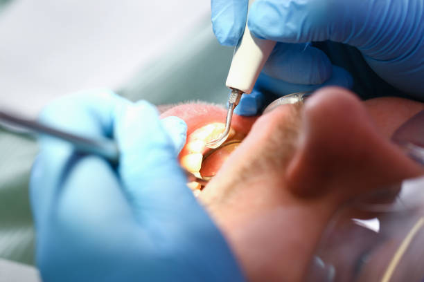 Best Knocked-Out Tooth Emergency  in Covina, CA