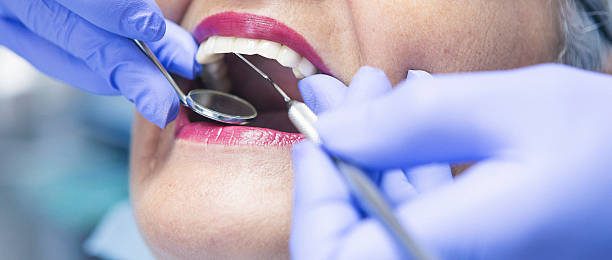 Best Knocked-Out Tooth Emergency  in Covina, CA